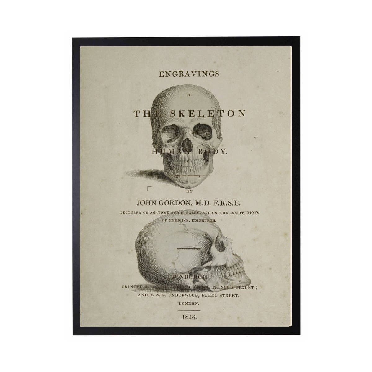 Framed Skull Poster